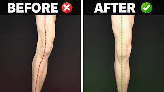 90% of Knee Pain Comes from THIS (do this instead)