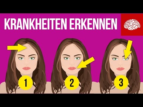 Ob das Ekzem auf den Fingern der Beine sein kann Atopitscheski die Hautentzündung das Krankenbild