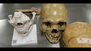 VÍDEO AULA PRÁTICA SISTEMA ARTICULAR PARTE 1 - CLASSIFICAÇÃO QUANTO AO TECIDO E MOBILIDADE