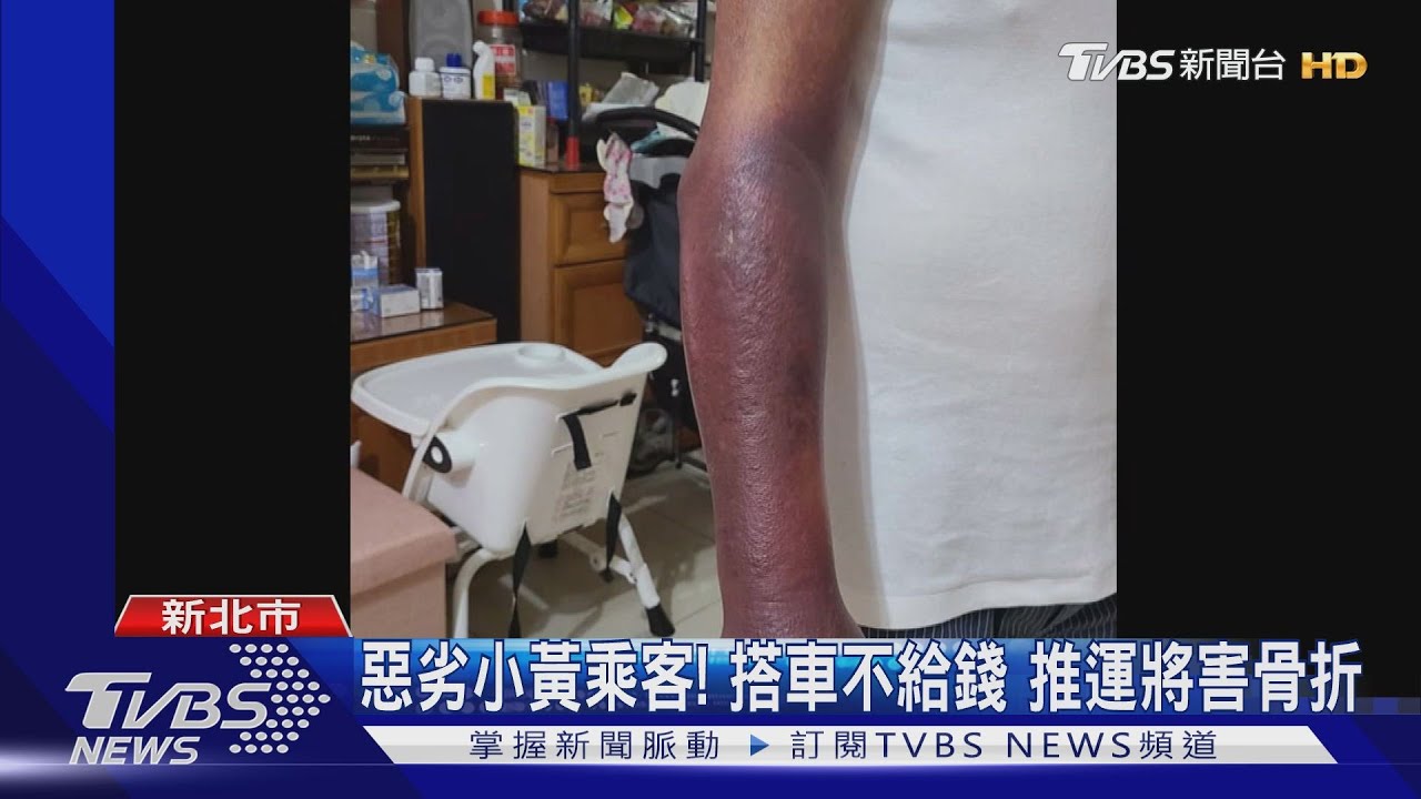 惡劣小黃乘客!搭車不給錢 推運將害骨折