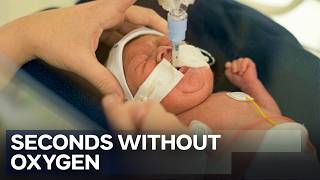 Life Support at 14 Weeks: The Harsh Reality of the Neonatal Clinic | Superhospital