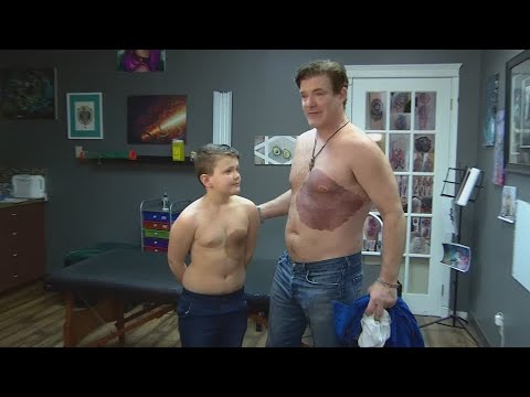 パパは息子のアザに合わせて巨大なタトゥーを入れて意識を低くする (Dad gets huge tattoo matching son's birthmark to make him less self conscious)