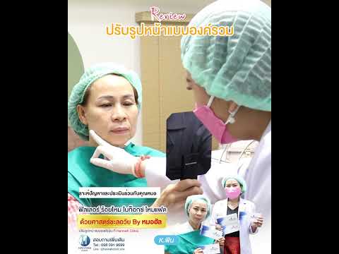 รีวิวปรับรูปหน้าแบบองค์รวมด้วยโปรแกรมฟิลเลอร์ โบท็อก ร้อยไหม ไหม Fat