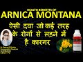 Arnica Homeopathic Medicine Arnica Montana Q 30 1M