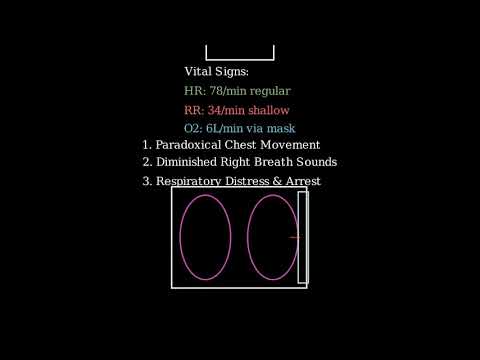 Client experienced chest trauma. Transported from disaster scene via stretcher