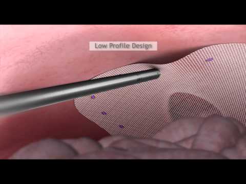 FasTouch(TM)  - Product Animation