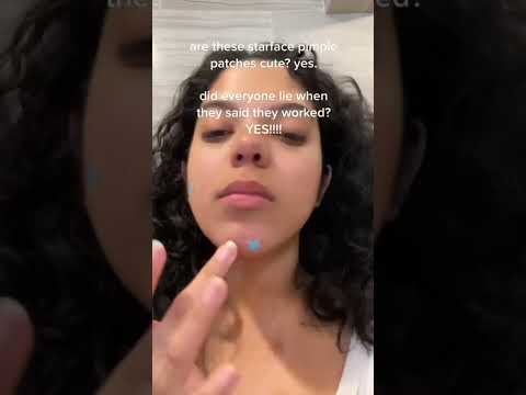anyone who says these starface pimple patches work is a stinky liar