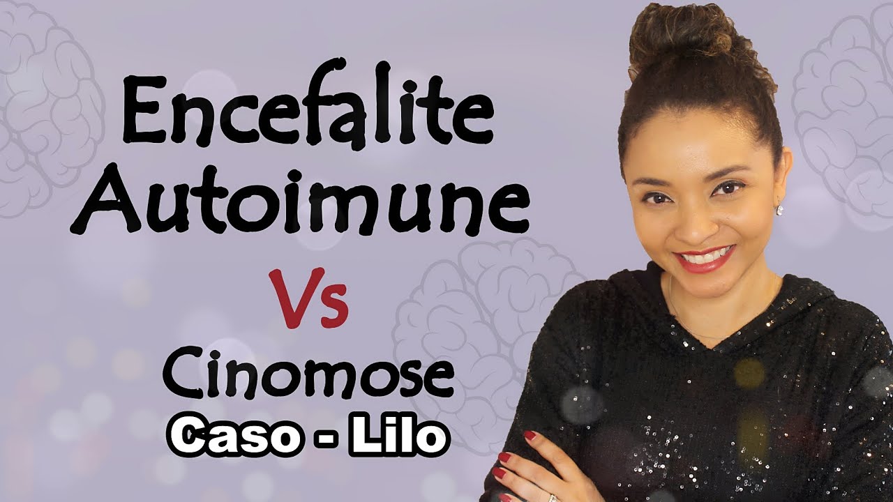 #ENCEFALITE AUTOIMUNE - CASO LILO. UMA DOENÇA QUE SE PARECE COM CINOMOSE.