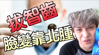 趣味生活-拔智齒後，臉會不會變腫呢？