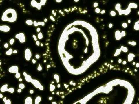 Vic's Infantility - Experiment