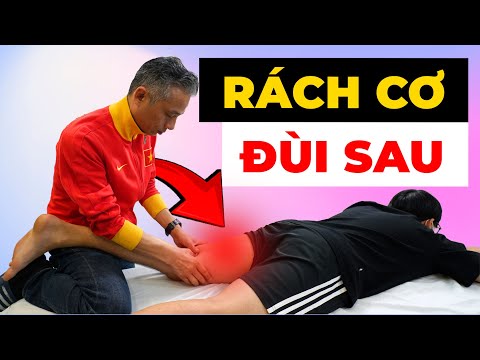 Rách Cơ Đùi Sau: Nỗi Ám Ảnh Của Vận Động Viên - Bác Sĩ Hướng Dẫn Điều Trị