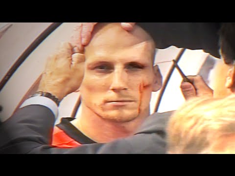 Jaap Stam eyebrow injury - EURO 2000 (Netherlands v Czech Republic)