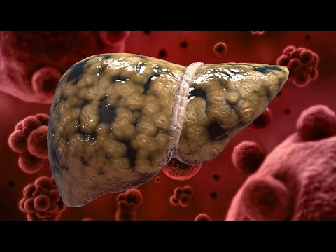 6 Foods That Naturally Cleanse the Liver Video