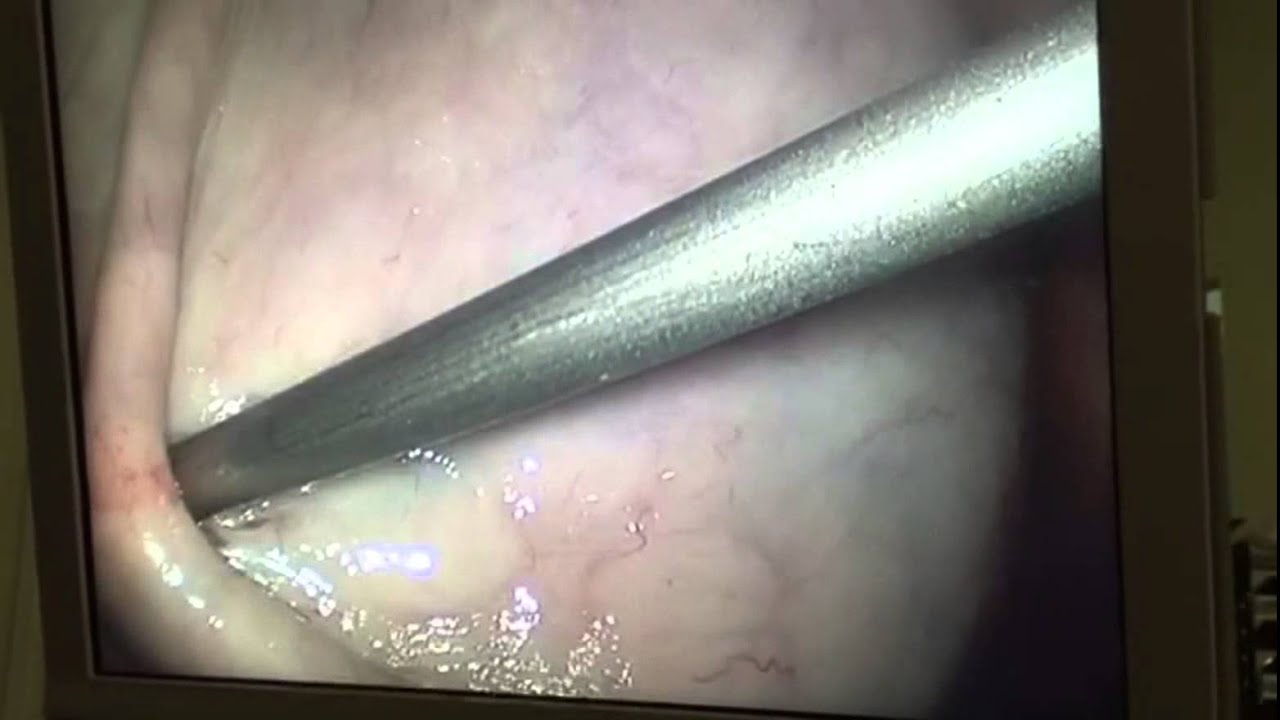 Brian Axel Rojas Bahena-11