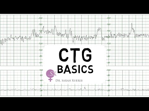 CTG Basics