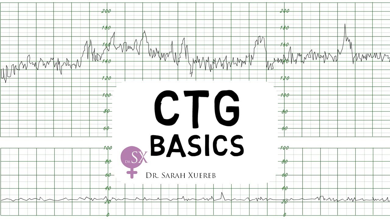 CTG Basics