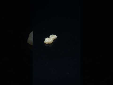 YouTube 썸네일
