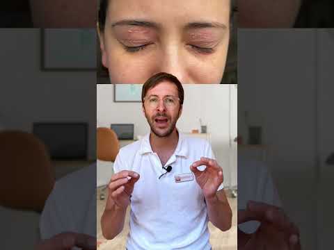 Eye eczema: Scaly skin around the eyes | DERMAFY #shorts #eyeeczema #eczema #neurodermatitis