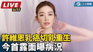 許維恩乳癌切乳重生　今首露面曝病況