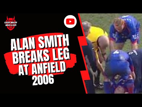Alan Smith Breaks Leg at Anfield 2006