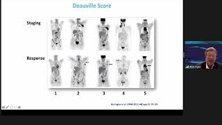 'Response assessment in lymphoma' by Prof. Wim Oyen, delivered at ICIS 2021