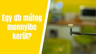 Mennyibe kerül egy műfog?