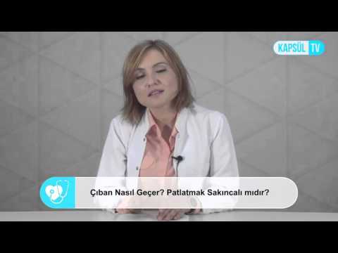 Çıban Nasıl Geçer? Patlatmak Sakıncalı Mıdır?