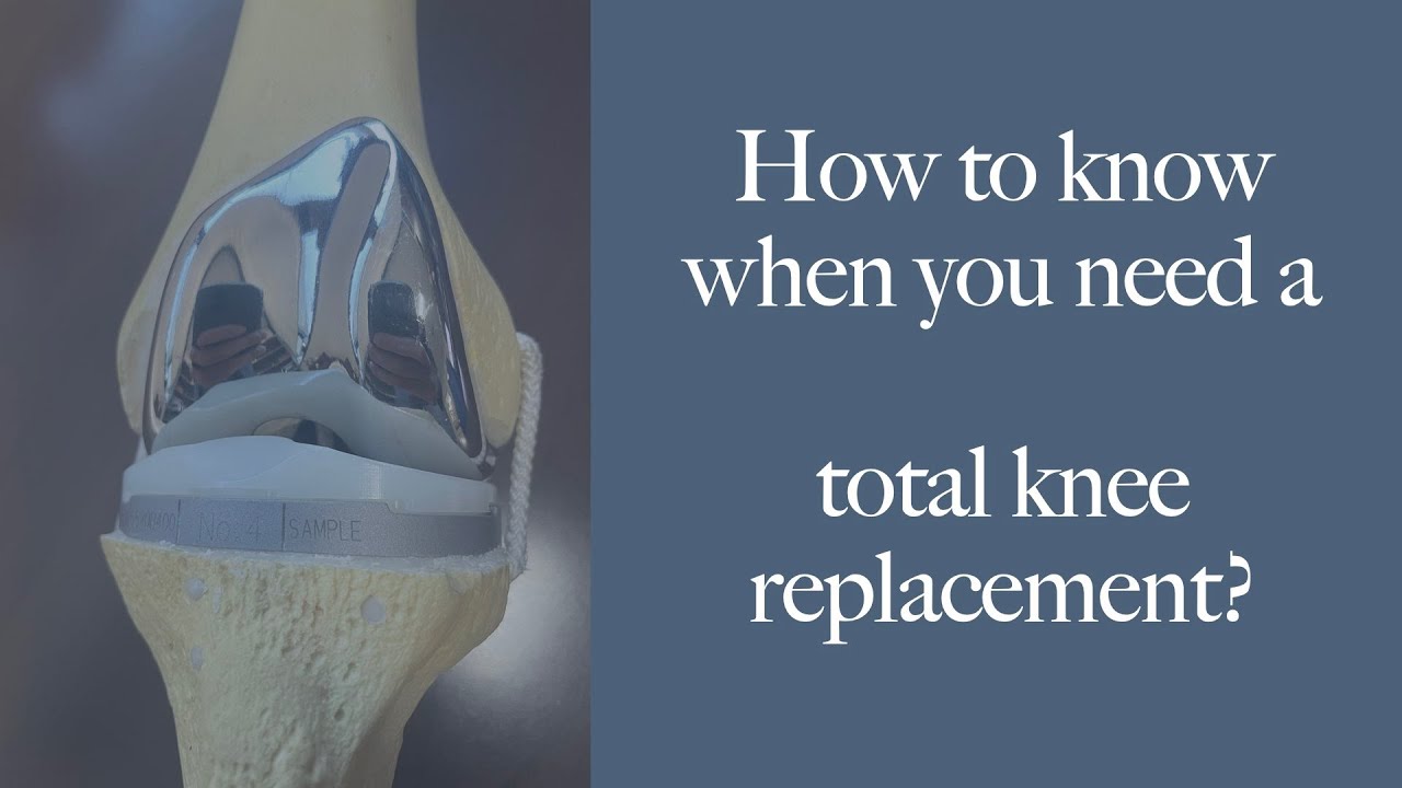 BEST REASONS to get a TOTAL KNEE replacement. How to know when & if you should have surgery