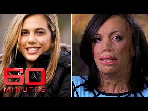Turia Pitt was burned alive during an ultra-marathon | 60 Minutes Australia