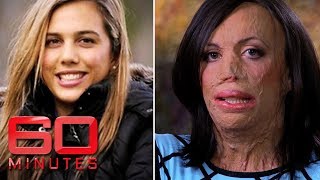 Turia Pitt was burned alive during an ultra-marathon | 60 Minutes Australia