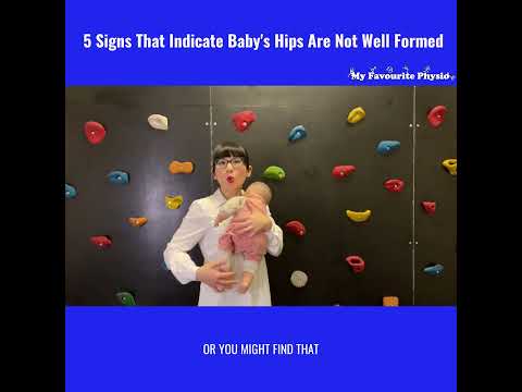 🔥🔥🔥5 Signs That Indicate That Baby’s 👶🏻 Hips Are Not Well Formed