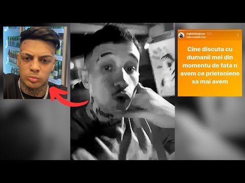 MGK666 THREATENS ALBERT NBN ON STORY, BUT HE RESPONDS IMMEDIATELY!!