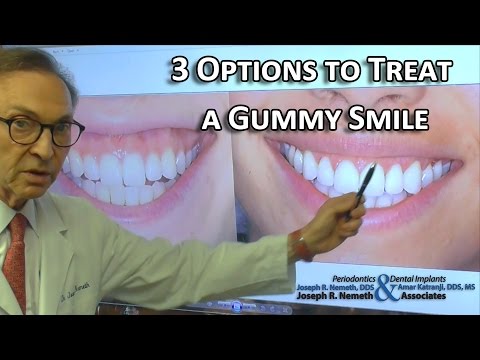 download lagu mp3 mp4 Gummy Smile Child, download lagu Gummy Smile Child gratis, unduh video klip Gummy Smile Child