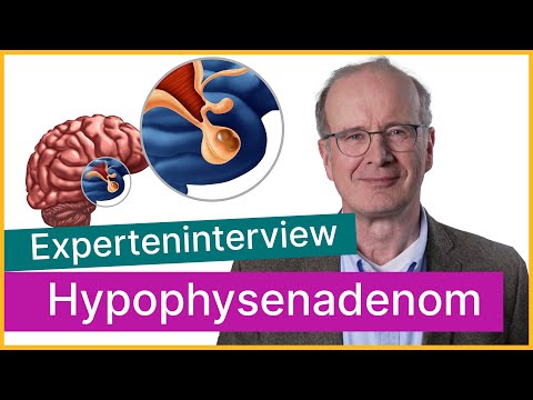 Tumor der Hirnanhangsdrüse: Was muss bei einem Hypophysenadenom beachtet werden? | Asklepios