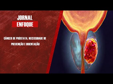 Médico urologista Eloi Moccellin fala sobre a importância de conscientização