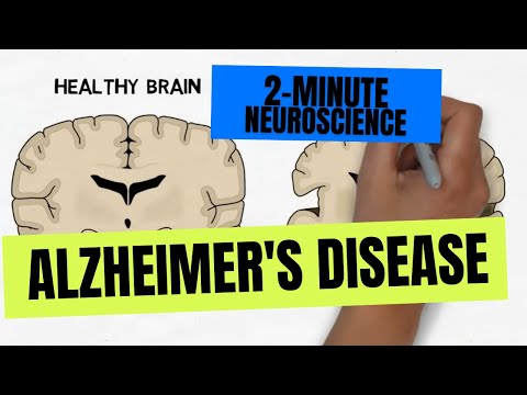 2-Minute Neuroscience: Alzheimer's Disease