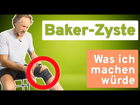 Effective self-help for Baker's cyst: My recommendations and tips
