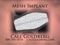 Goldberg Mesh Implant