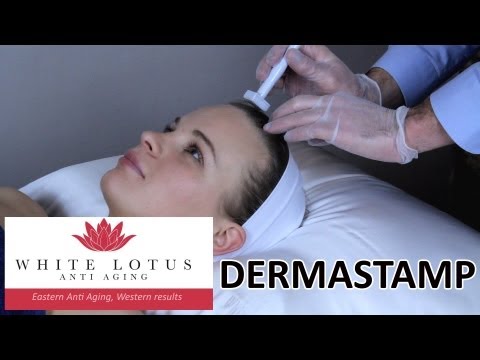 Dermastamp