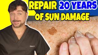 Repair 20 Years Of Sun Damage Dark Skin Marks And Spots In Minutes