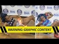 Viral Fire Crotch Dancer My Vagina Survived TMZ