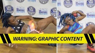 Viral Fire Crotch Dancer -- My Vagina Survived!!  