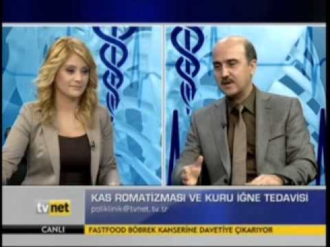Kas romatizması ve kuru iğne tedavisi - Dr. serdar SARAÇ - TVnet Poliklinik Bölüm 3