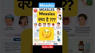 Measles !! #causes #symptoms #diagnosis #management #medicalshorts #medicalnotes #nursingnotes