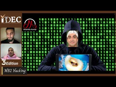 Hacking the MB2.. How to Know, Locate, Find and Shape the MB2 in Maxillary Molars (Upper 6 Mainly)