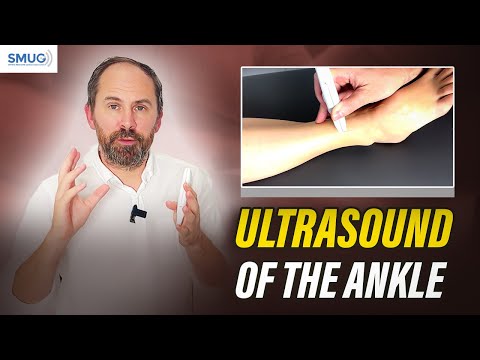 MSK Ultrasound Anterior & Lateral Ankle Scan | Clinical Step-by-Step Guide