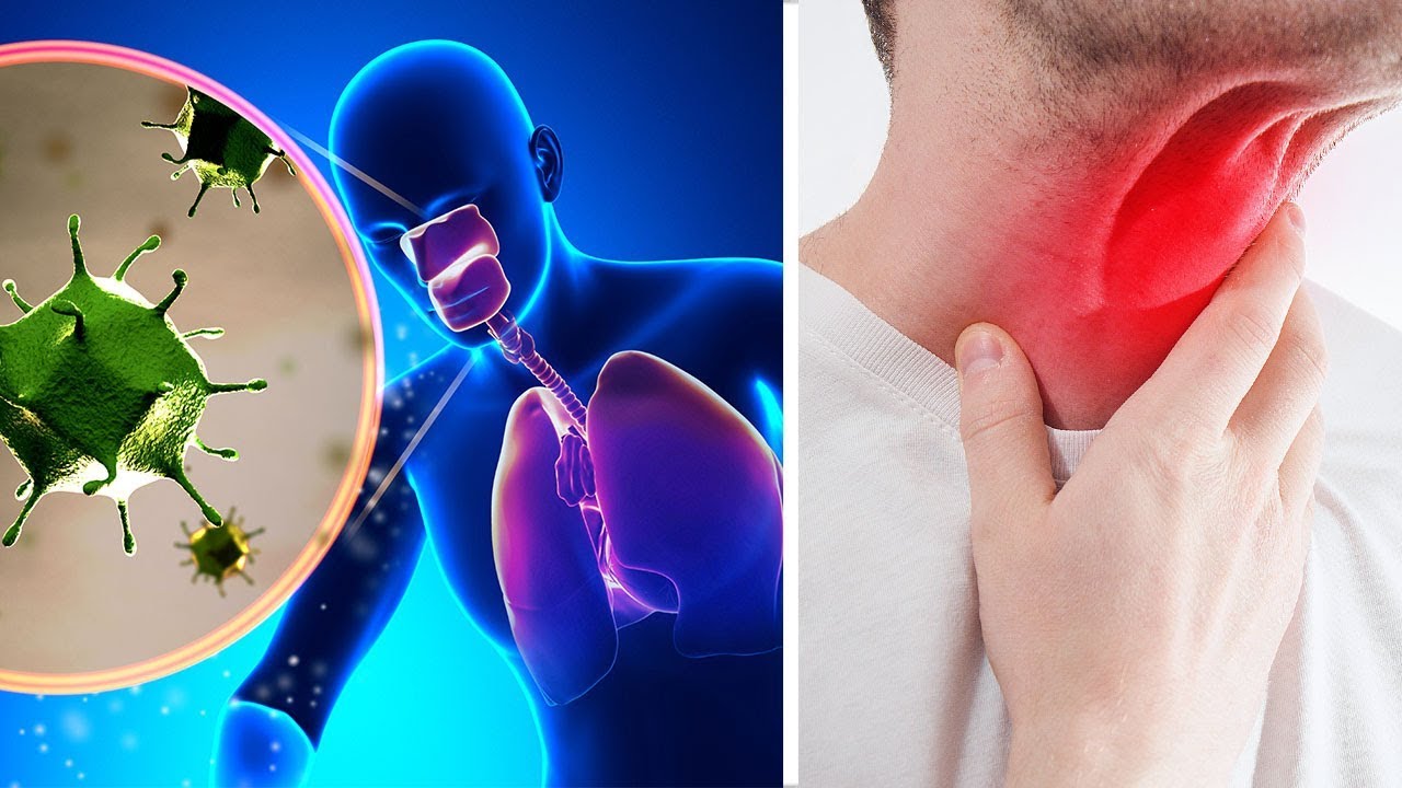 5 Tipps um verschleimte Bronchien und Schleim aus dem Rachen loszuwerden!