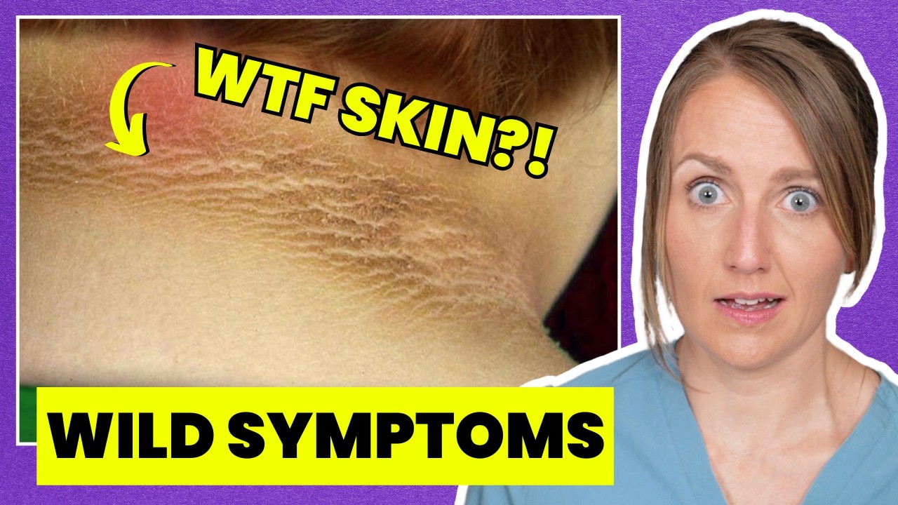 7 PCOS Symptoms You’ve Never Heard About