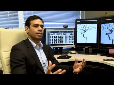 Medical Insight: Stroke - Essentia Health