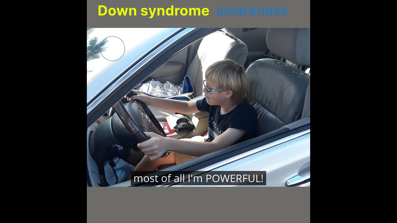 Treble J is spreading awareness about Down syndrome